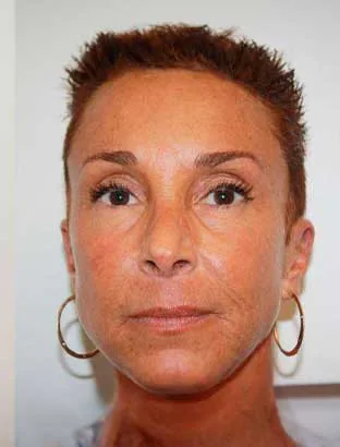 Laser & skin at Paradise Medspa & Wellness
